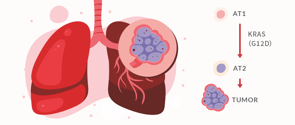 KRAS（G12D）頭圖.png