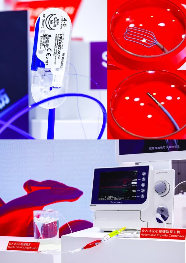 上起：強(qiáng)生醫(yī)療科技帶來心力衰竭治療領(lǐng)域的重磅創(chuàng)新產(chǎn)品Impella&reg; CP with SmartAssist介入式左心室輔助泵；強(qiáng)韌守護(hù)連續(xù)縫合新一代單股不可吸收性縫線普諾瓦；創(chuàng)新槳型設(shè)計(jì)一次性使用磁定位標(biāo)測(cè)導(dǎo)管OPTRELL?；擁有智能精準(zhǔn)壓力指示和多孔灌注技術(shù)的多電極空腔導(dǎo)管STSF