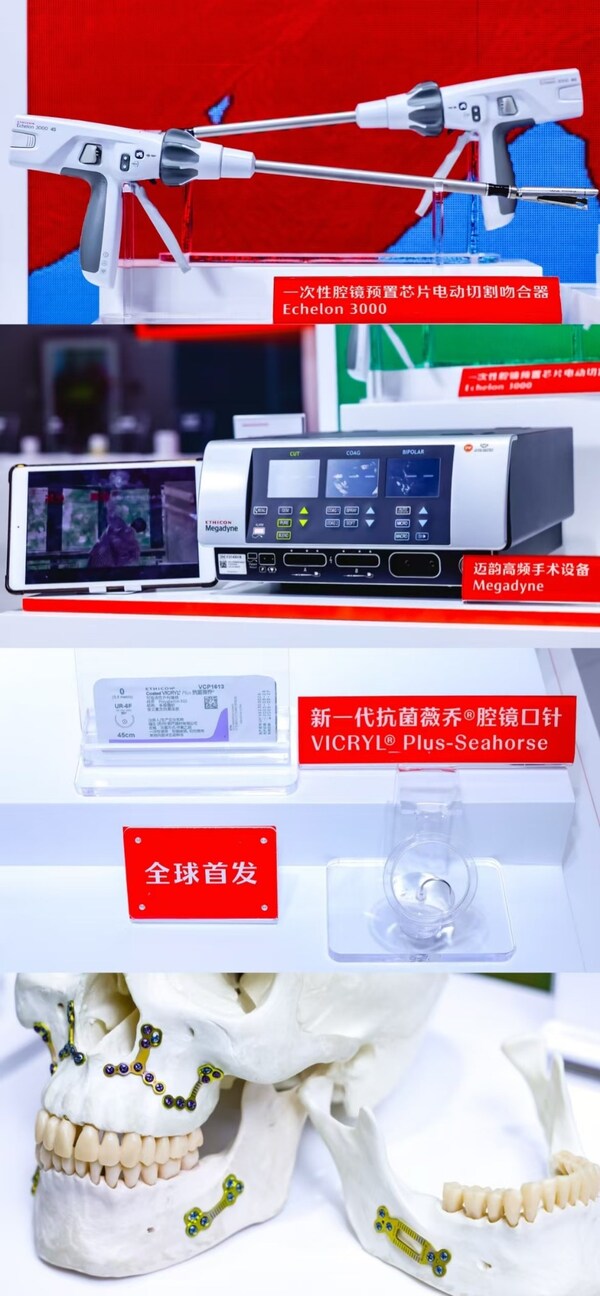 上起：強(qiáng)生醫(yī)療科技中國(guó)首發(fā)最新一代預(yù)置芯片吻合器愛惜龍3000吻合器；中國(guó)首發(fā)第一款高頻手術(shù)設(shè)備Megadyne邁韻高頻手術(shù)設(shè)備；全球首發(fā)新一代抗菌薇喬&reg;腔鏡口針；專為亞洲人群設(shè)計(jì)的正頜矯正固定系統(tǒng)Matrix ORTHOGNATHIC LOCK?