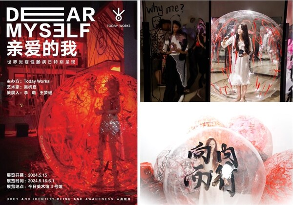 《親愛(ài)的我》炎癥性腸病公益藝術(shù)展