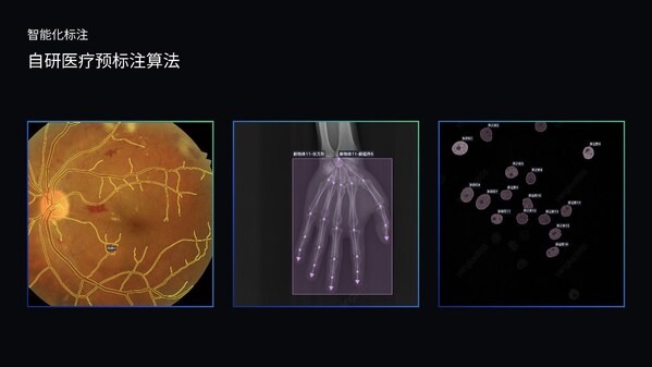 澳鵬MediGo平臺集成醫(yī)療專用NER模型、問答對自動生成系統(tǒng)和自研預(yù)標注算法