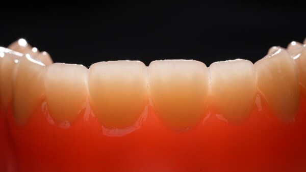 多材料一體打印活動(dòng)義齒