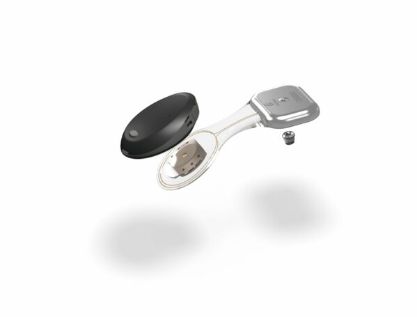 科利耳最新一代Osia?主動(dòng)式骨傳導(dǎo)植入系統(tǒng)