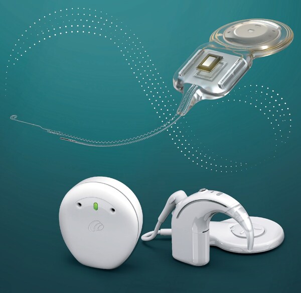 科利耳Nucleus? Nexa智能人工耳蝸系統(tǒng)